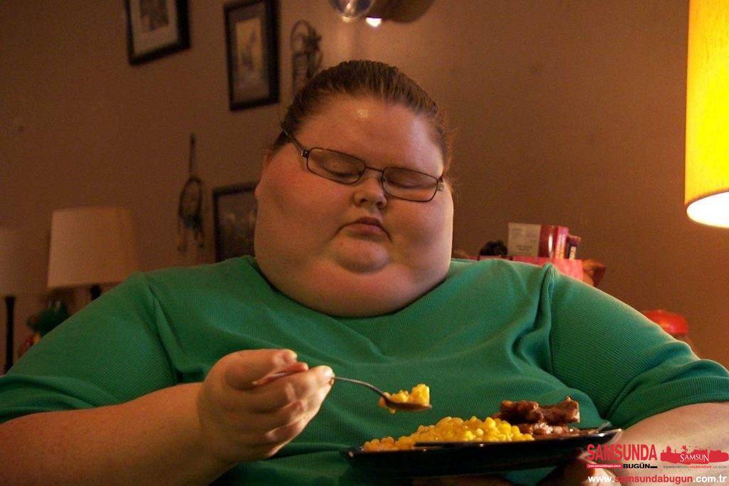 Obezite toplumun genel sağlık yapısını bozabilen bir hastalık