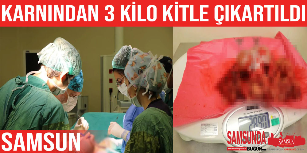 Genç kadının karnından 3 kiloya yakın kitle çıkarıdı