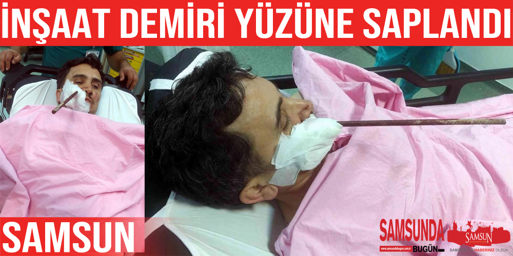 Yüzüne saplanan demirle hastaneye kaldırıldı