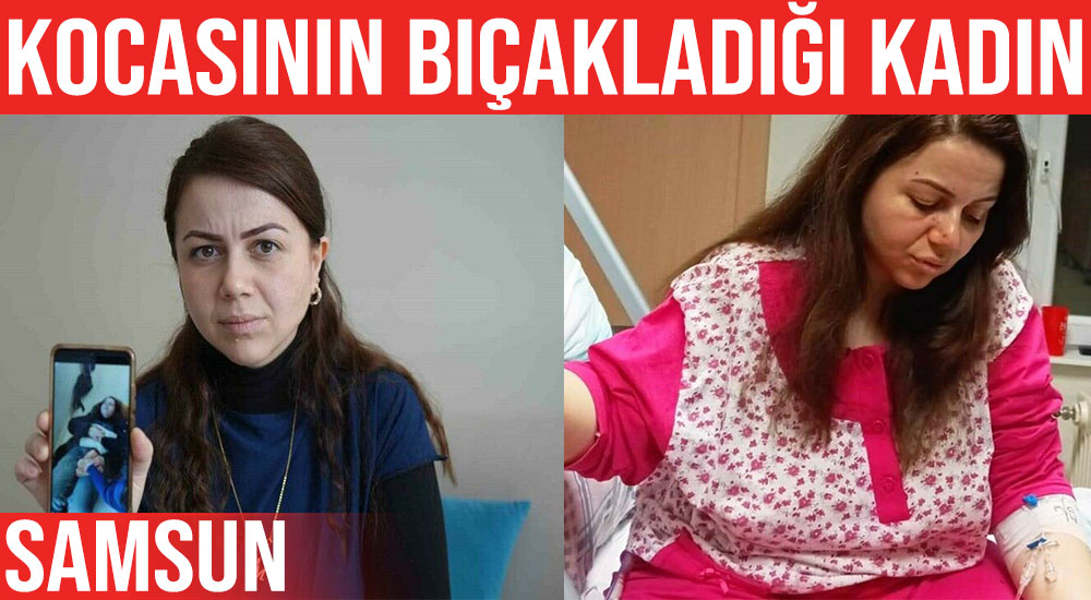 Samsun’da Kocası Tarafından Bıçaklanan Kadın Konuştu